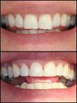 Reshaping and Polishing