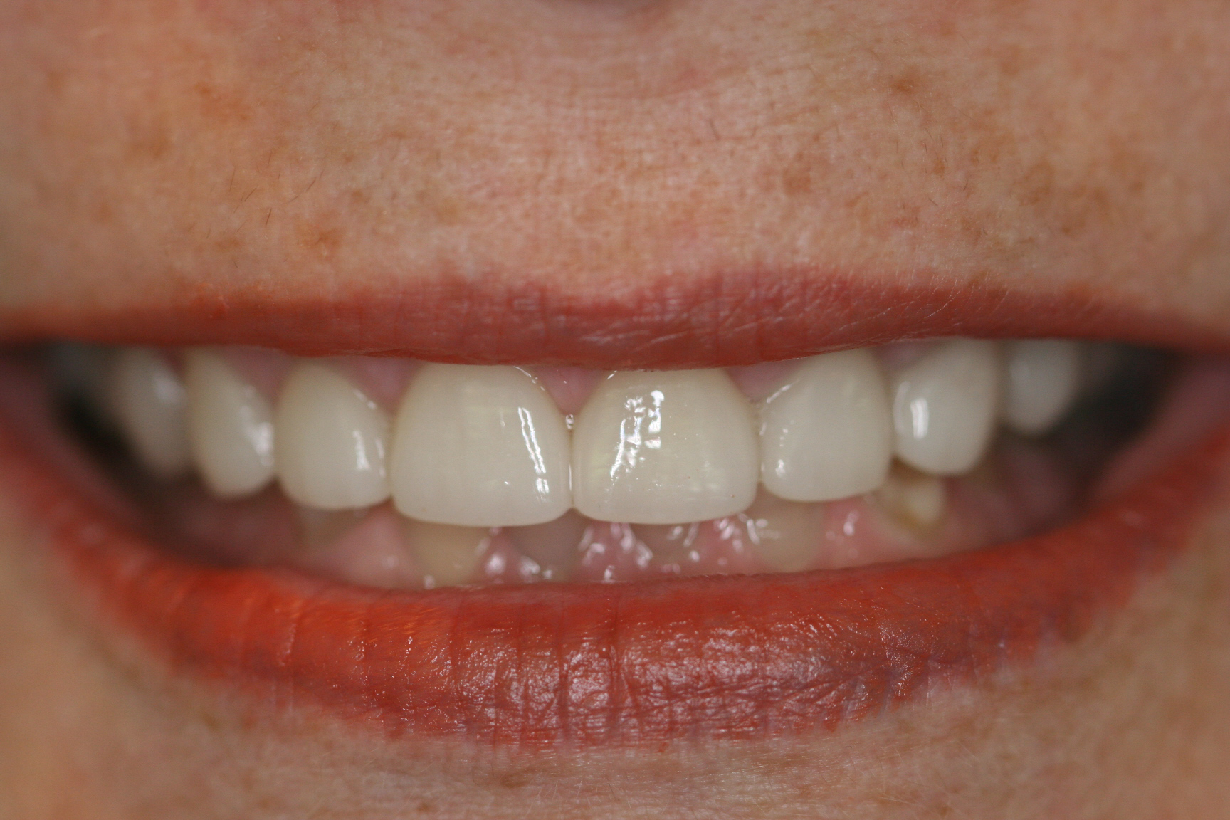 Ginger — after treatment, photo 2