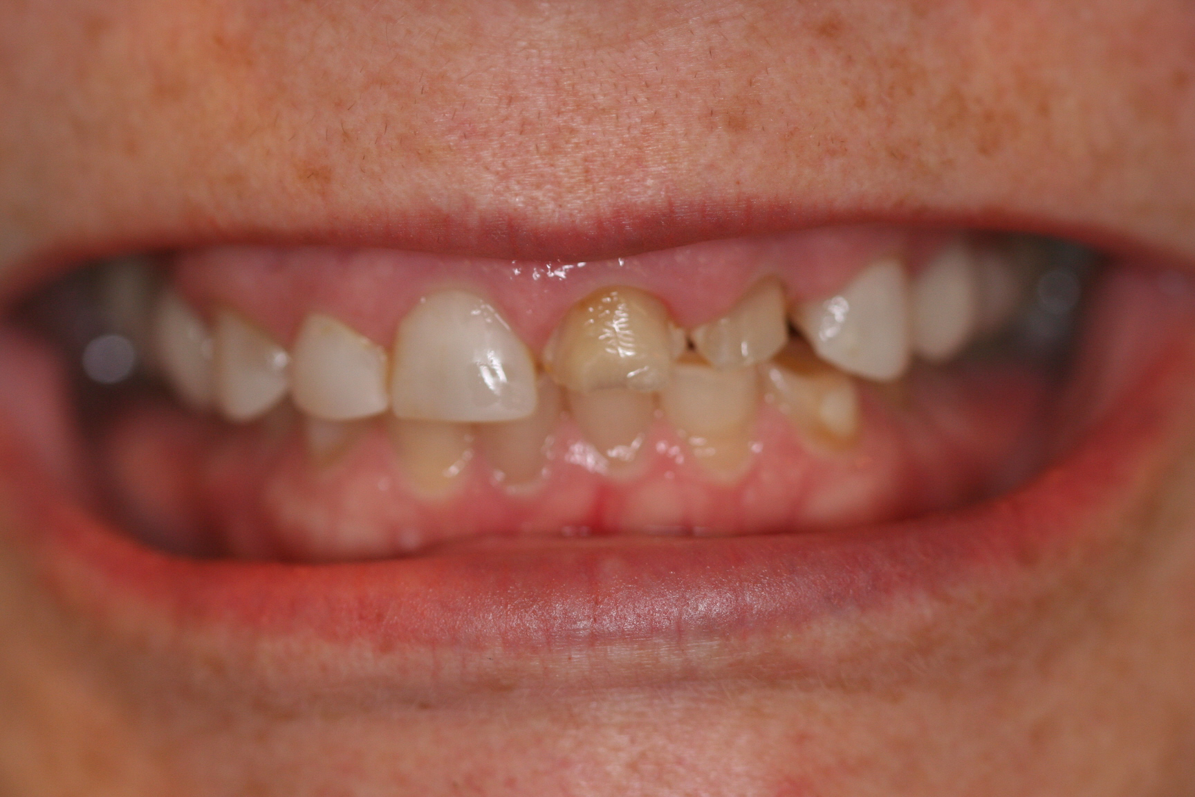 Ginger — before treatment, photo 2
