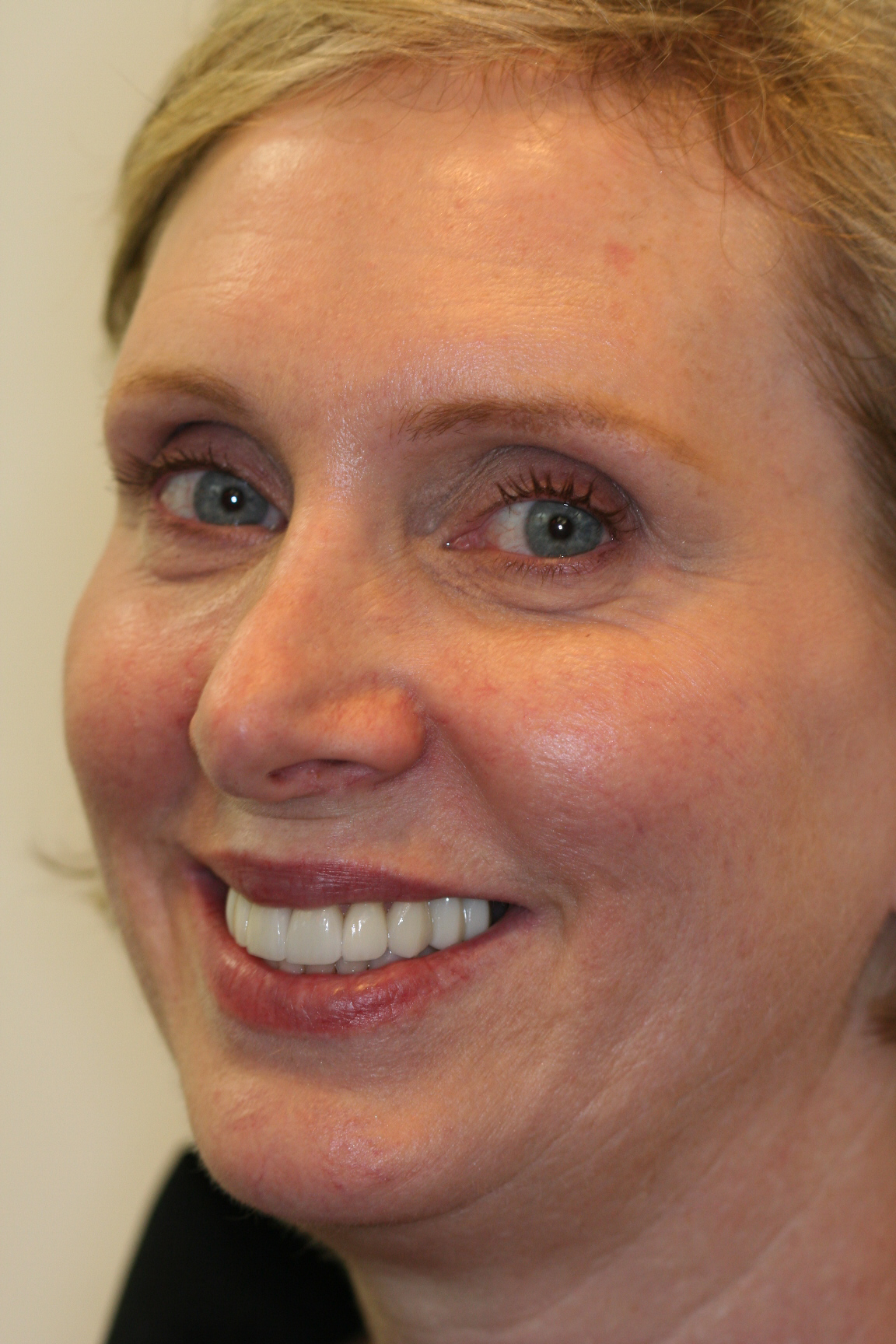 Megan — after treatment, photo 1