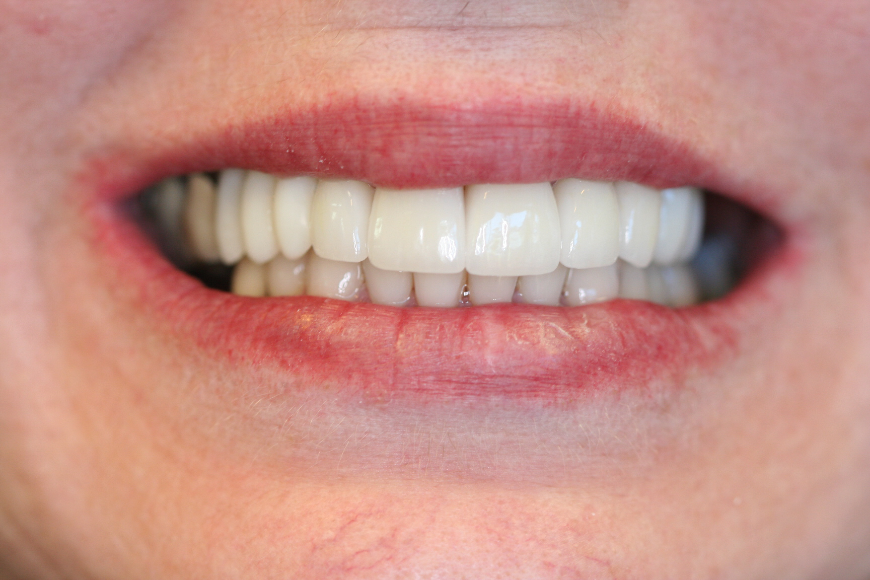 Megan — after treatment, photo 2