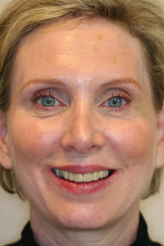 Megan — before treatment, photo 1