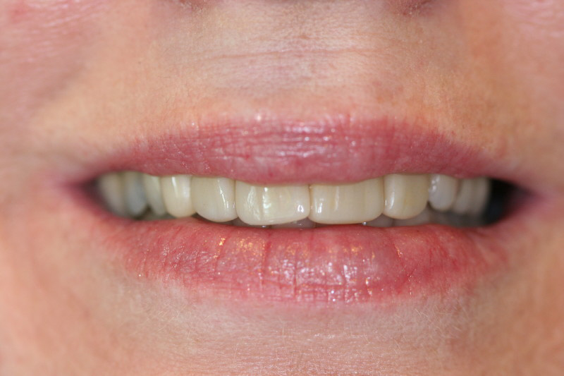 Megan — before treatment, photo 2