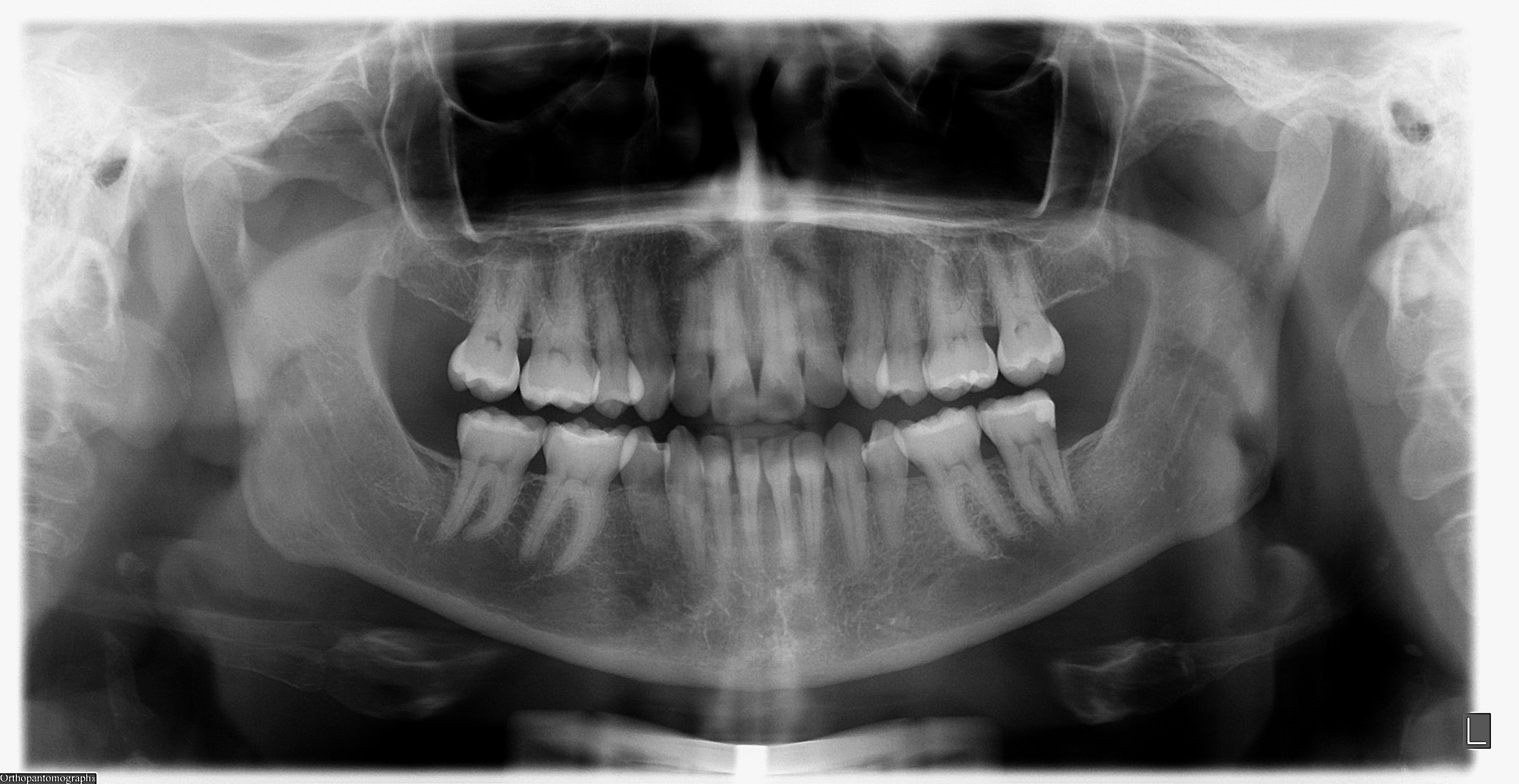 Nancy — before treatment, photo 1