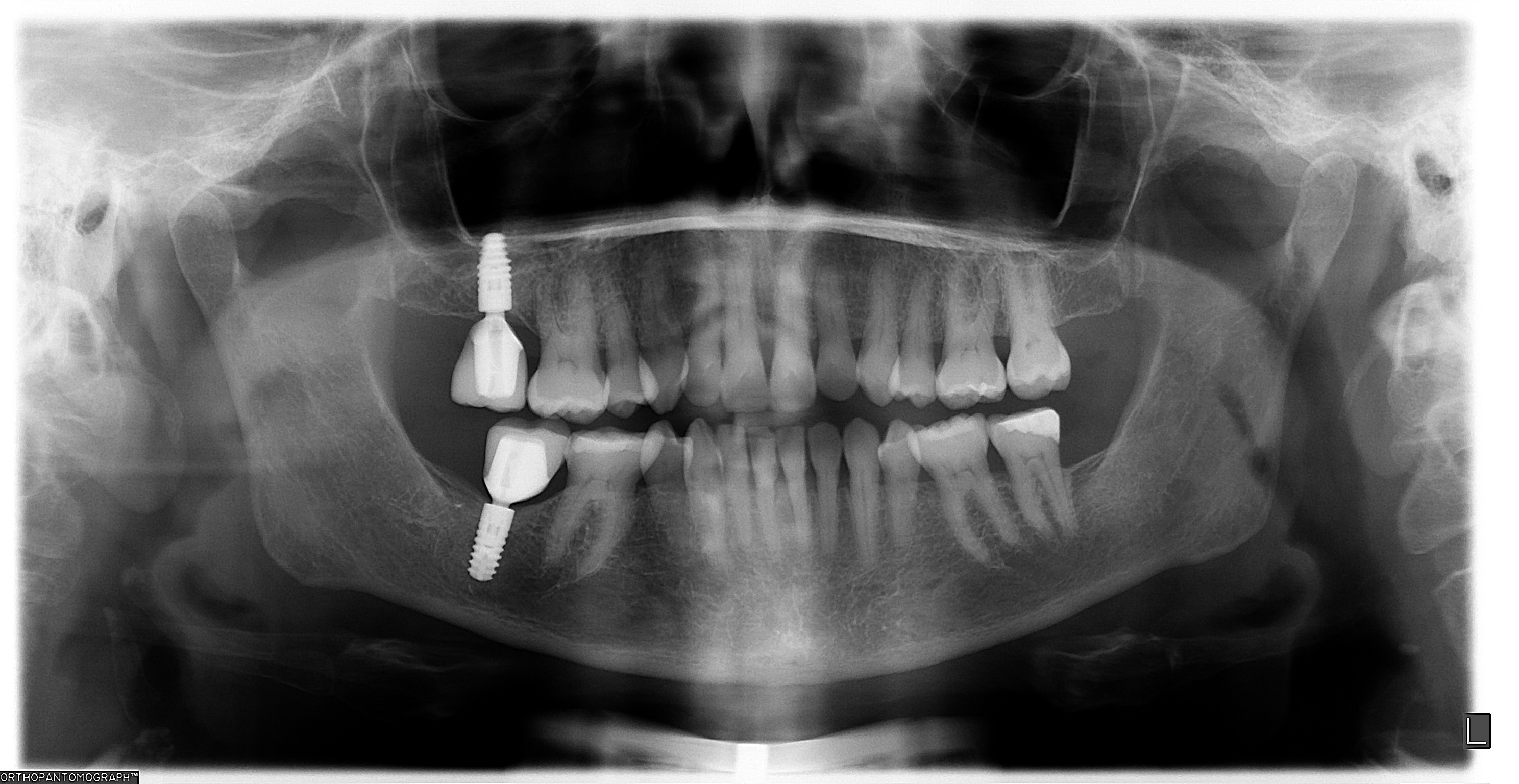 Nancy — after treatment, photo 1