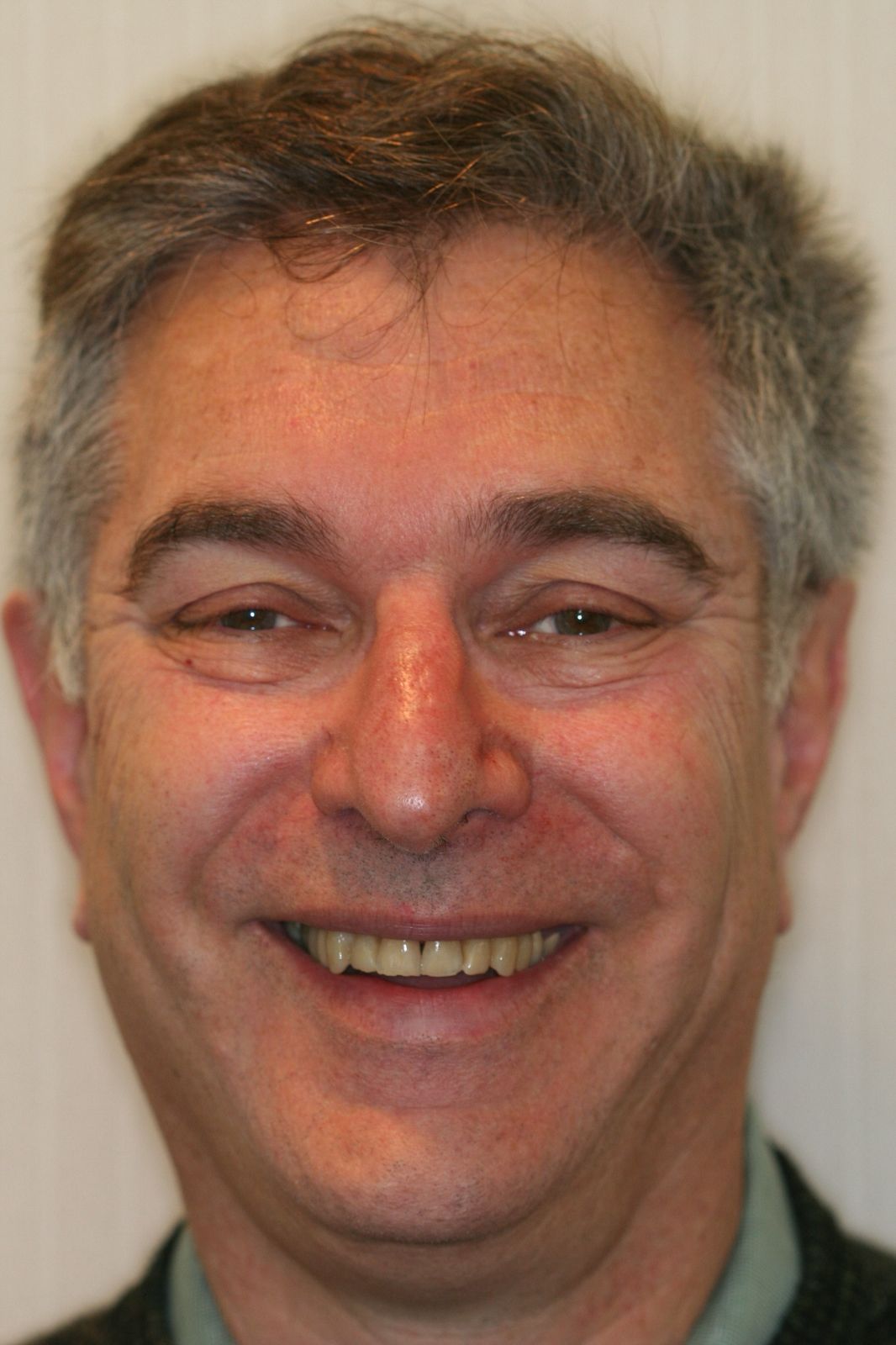 Richard — before treatment, photo 1