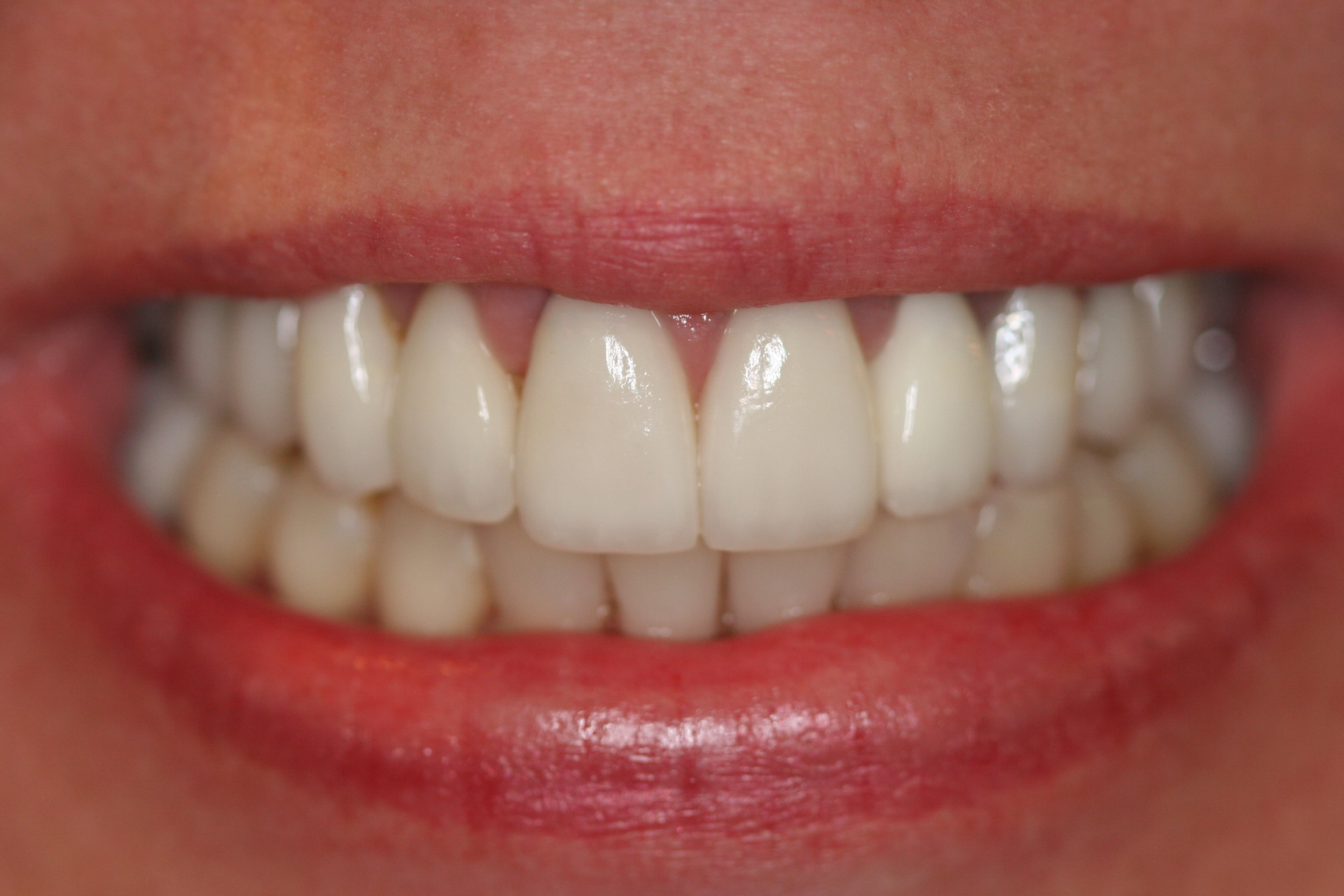 Robin — after treatment, photo 2