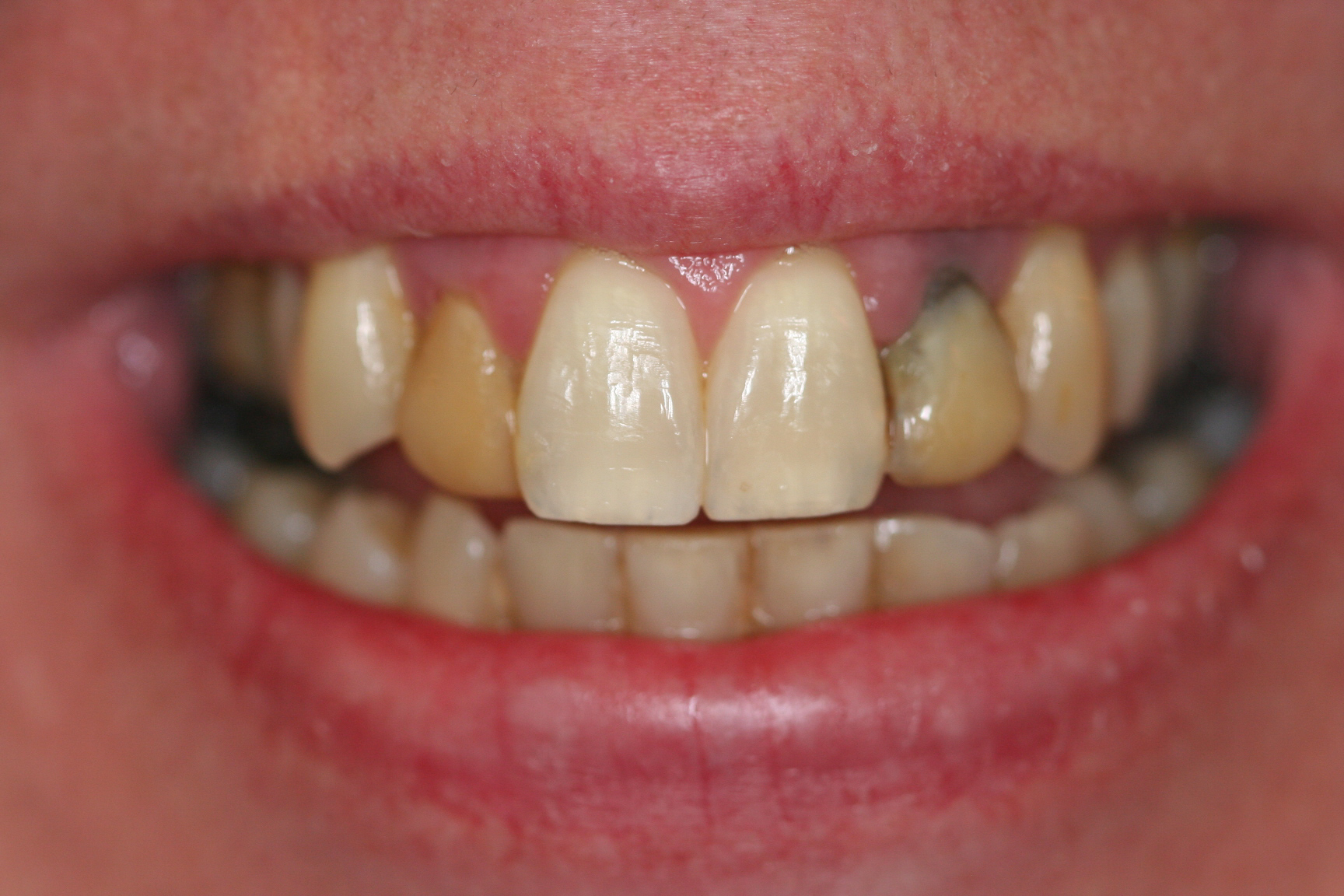 Robin — before treatment, photo 2
