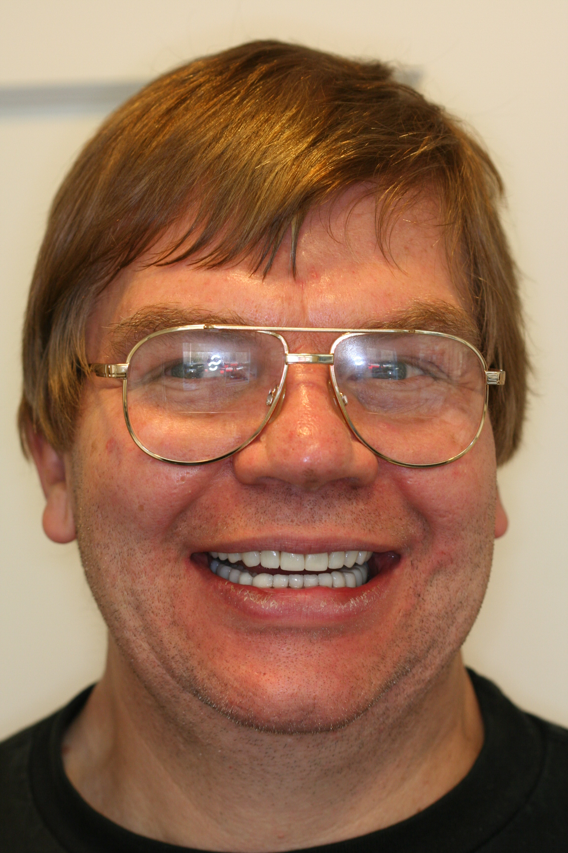 Garth — after treatment, photo 1