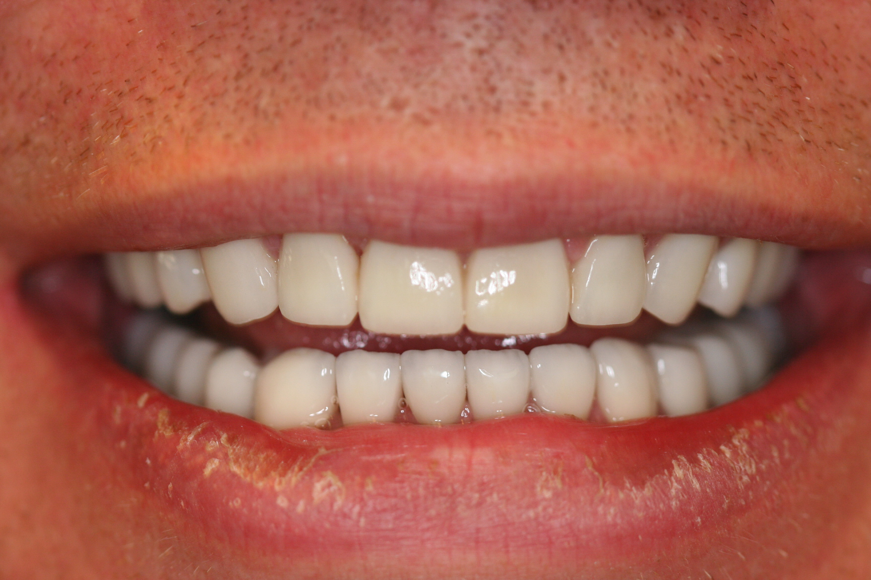 Garth — after treatment, photo 2