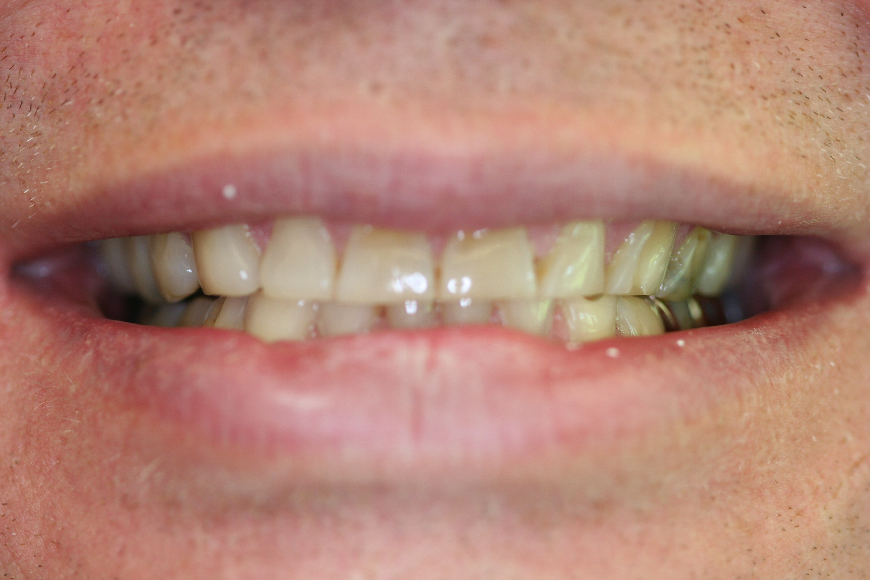 Garth — before treatment, photo 2