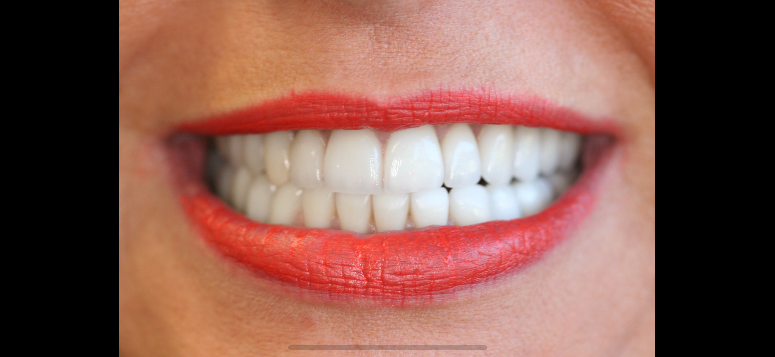 Marielle — after treatment, photo 2