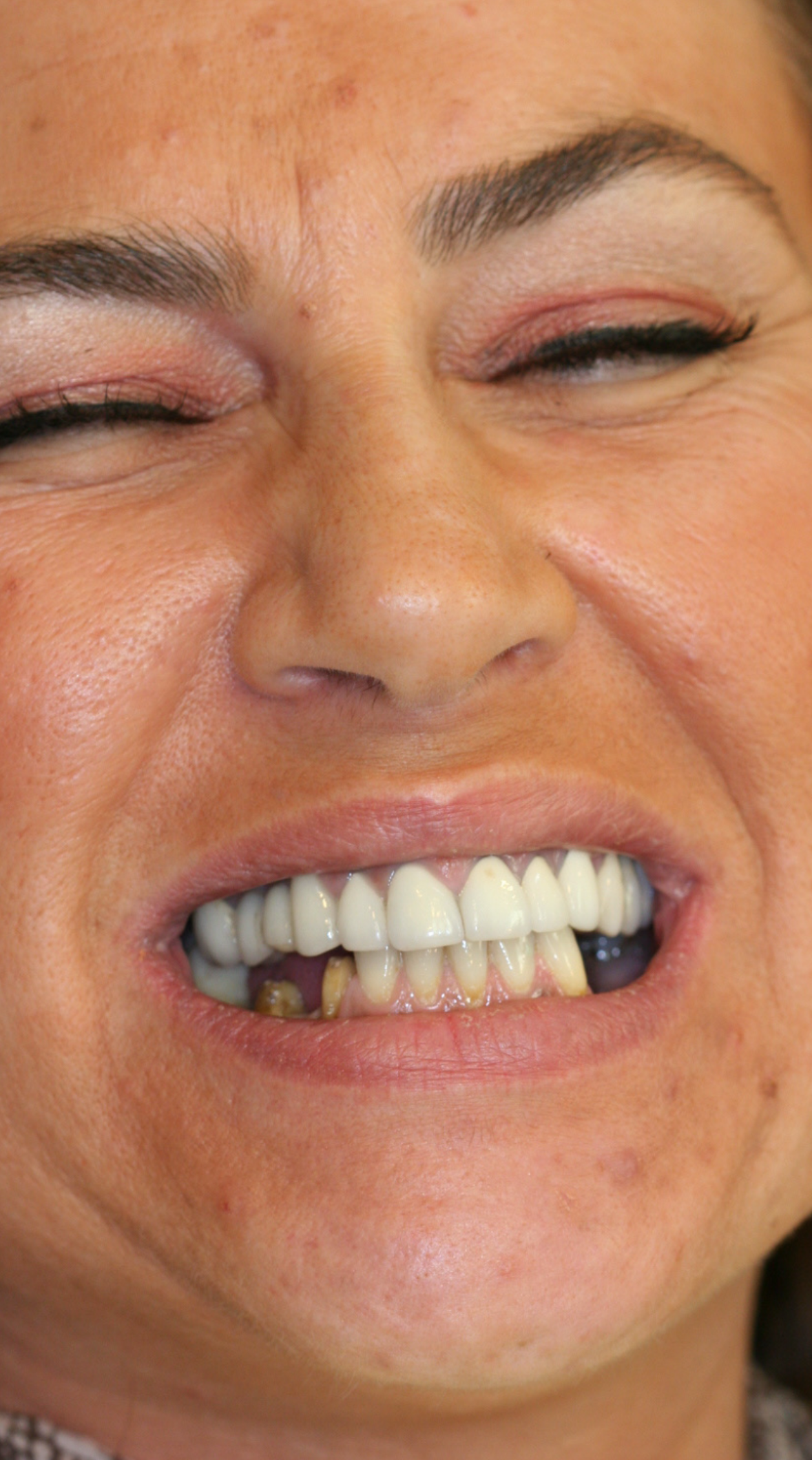 Marielle — before treatment, photo 1