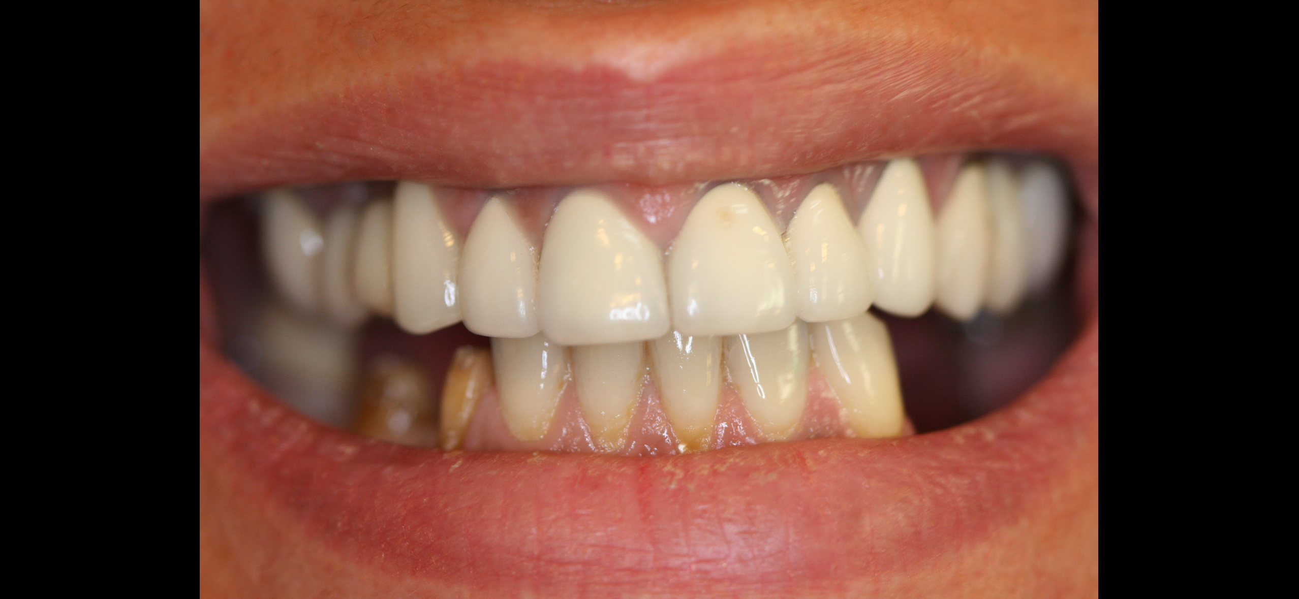 Marielle — before treatment, photo 2
